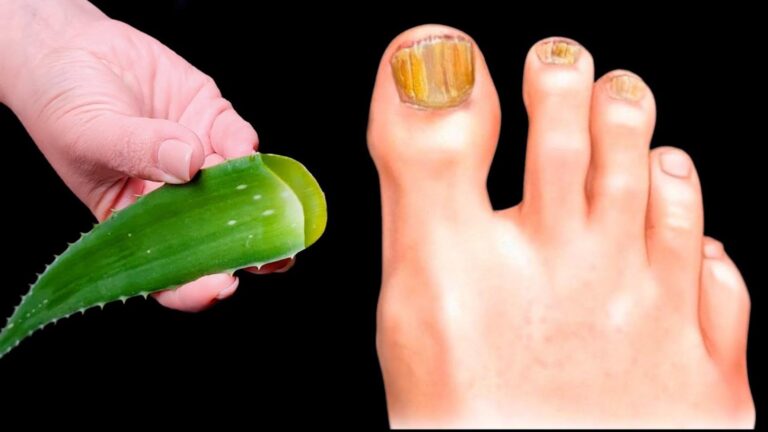 Cette astuce simple transforme vos ongles abîmés en un éclat sain…