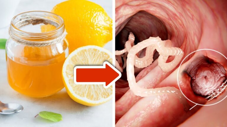Éliminez les vers digestifs : 3 astuces avec zeste de citron et miel à découvrir !