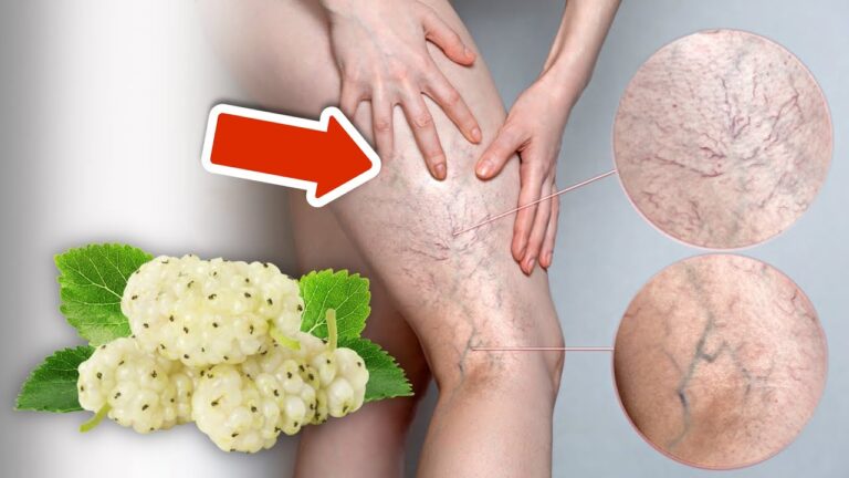 Découvrez 5 fruits étonnants pour réduire les varices naturellement !