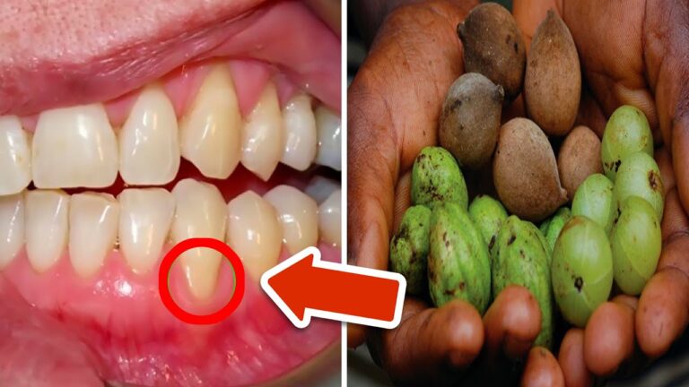 3 fruits incroyables pour des dents et gencives en pleine forme ! Découvrez-les !