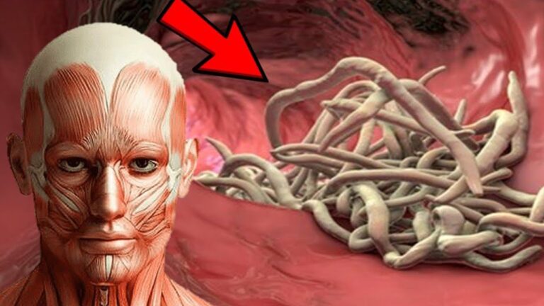 7 signes surprenants que votre corps abrite des parasites, à ne pas ignorer !