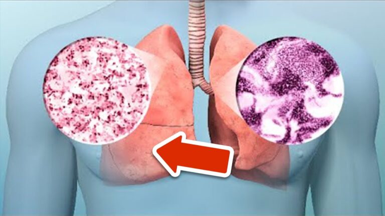 8 signes de cancer du poumon à ne jamais ignorer pour ta santé !