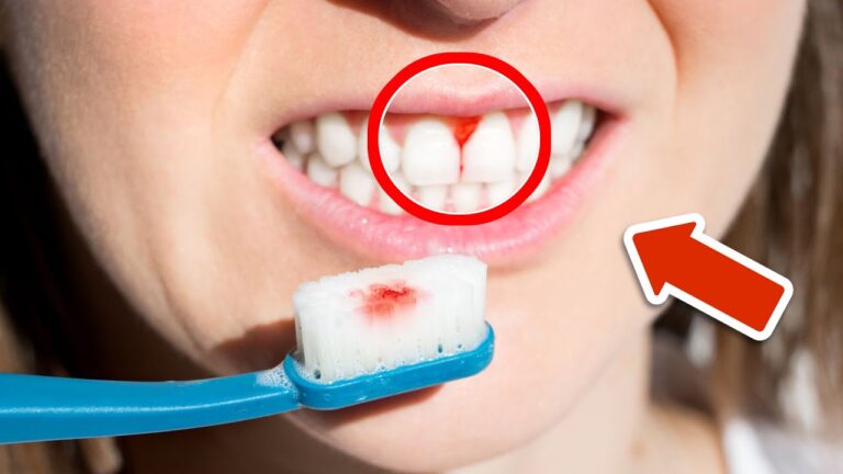 7 raisons surprenantes du saignement des gencives à connaître absolument !