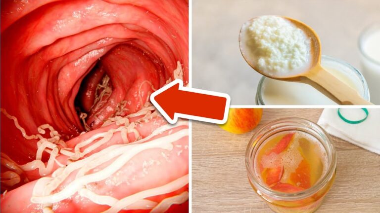 4 aliments surprenants pour éliminer naturellement les vers intestinaux !